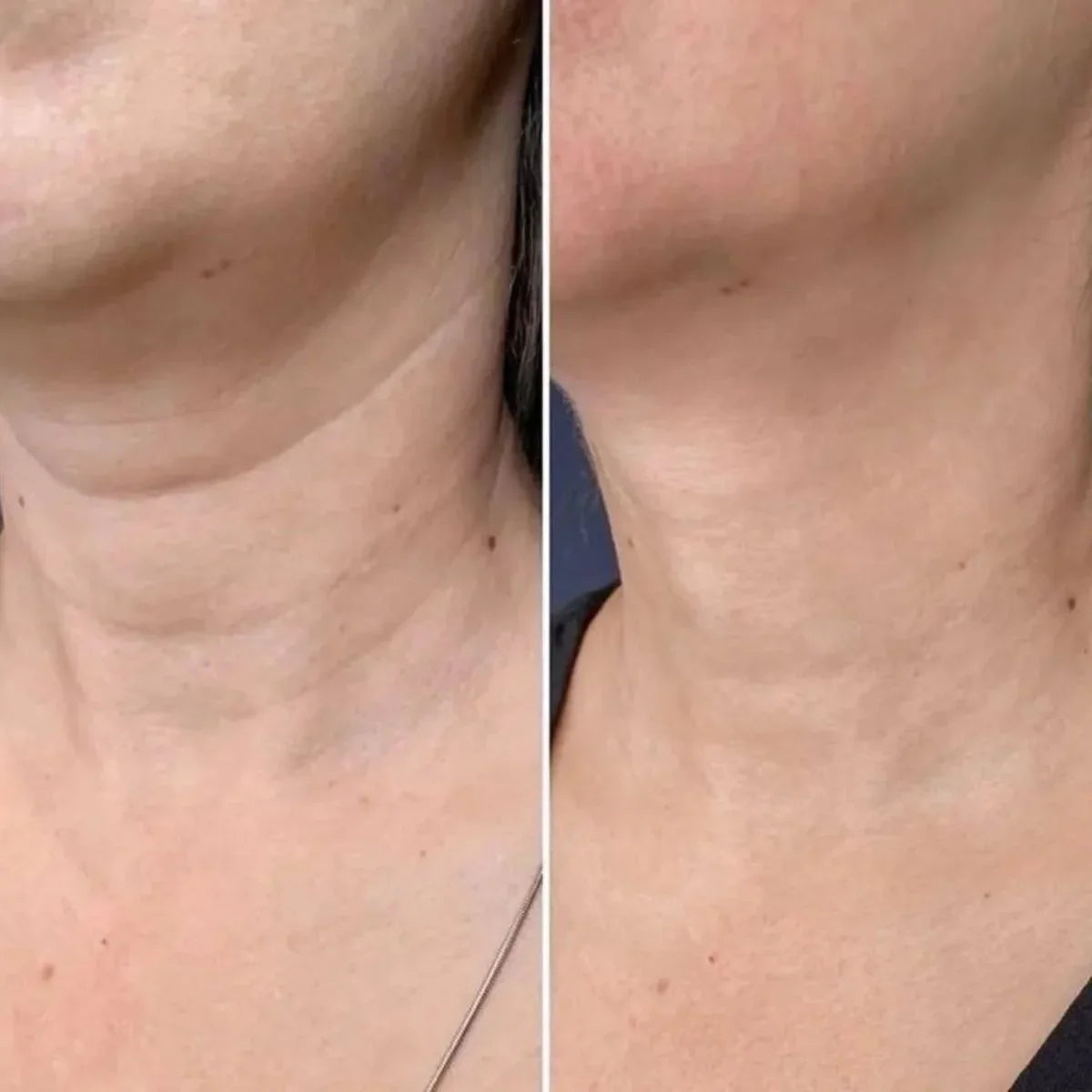 🌼Roller Massage Neck Cream 🧴 Collagen & Hyaluronic Acid | Firms Neck, Reduces Wrinkles & Double Chin