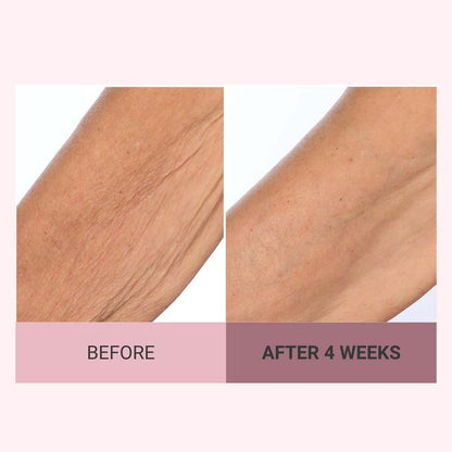 🌟 Experience the Glow of Firmer, Smoother, More Radiant Skin✨