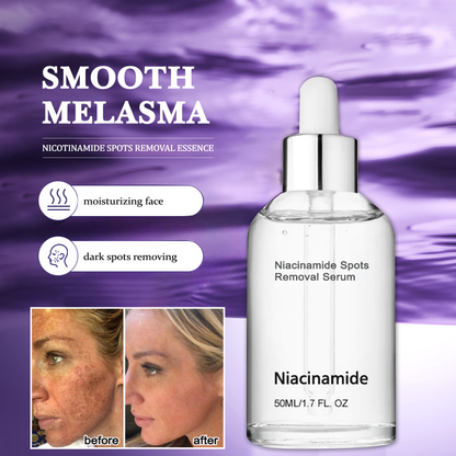 10% Niacinamide Spots Removal Serum 🎉Second Item half price🎉