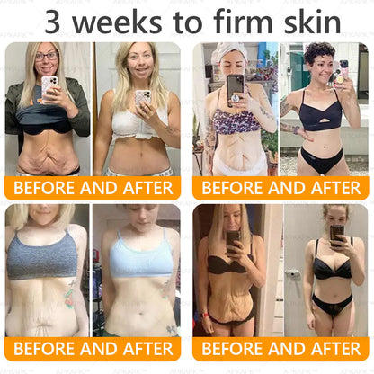 Made and Shipped from USA ✨ LBMLBM™ Bee venom Comprehensive Cream 🔥 LAST DAY 80% OFF 💎💎