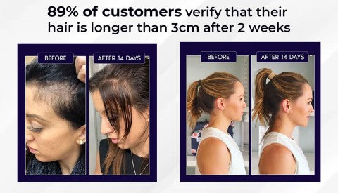 🌿 LOVILDS™ Natural Hair Regrowth Spray – 70% OFF Ends Tonight!