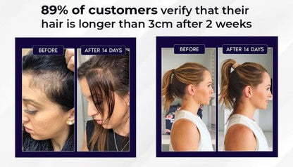 🌿 LOVILDS™ Natural Hair Regrowth Spray – 70% OFF Ends Tonight!