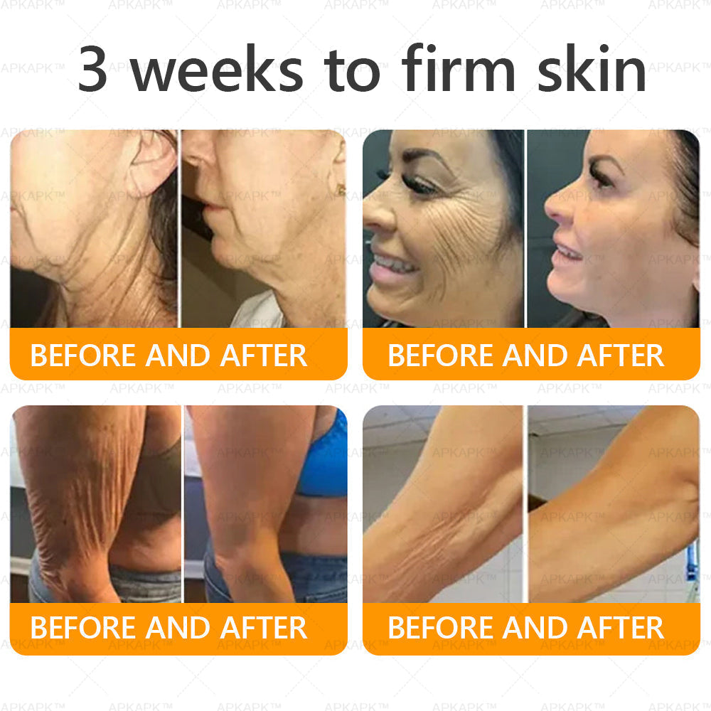 Made and Shipped from USA ✨ LBMLBM™ Bee venom Comprehensive Cream 🔥 LAST DAY 80% OFF 💎💎