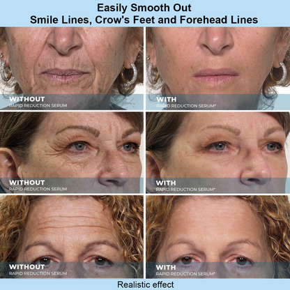 KLENIMORE™ Instant Face Temporary Tightener – Instant visible results in 30 seconds