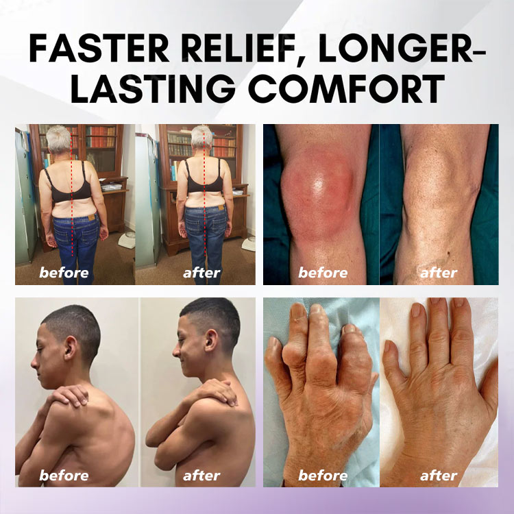 LOVILDS™ Turmeric & Emu Oil Arthritis Soothing Pain Relief Massage Gel