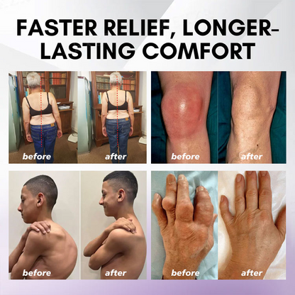 LOVILDS™ Turmeric & Emu Oil Arthritis Soothing Pain Relief Massage Gel