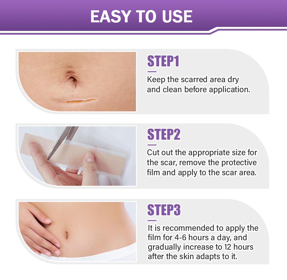 ✅ TAILEDEN™ Official | Nano Microneedle Scar & Wrinkle Repair Tape 🌿 Targets Scars, Fine Lines, Skin Laxity – Multi-Area Use (1.6in x 59in)