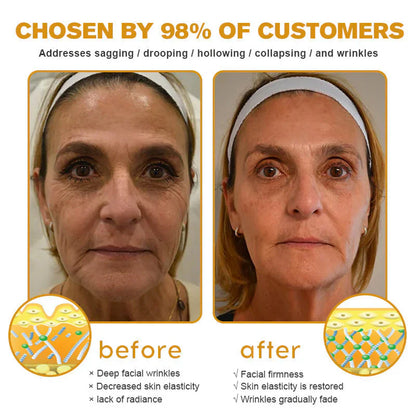👨‍⚕️ Made and Shipped from US✅   Bee Venom Wrinkle Removal Cream- LAST DAY 80% OFF