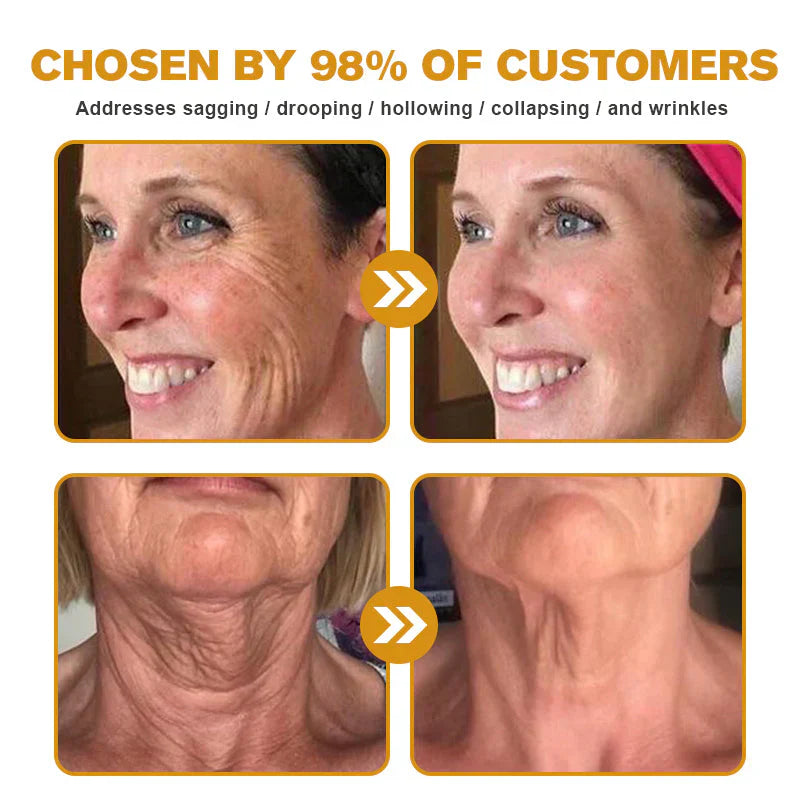👨‍⚕️ Made and Shipped from US✅   Bee Venom Wrinkle Removal Cream- LAST DAY 80% OFF