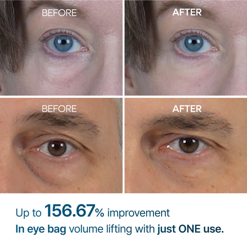 RevitaEye Cream New Formula, Ultimate Lift & Smooth Finish