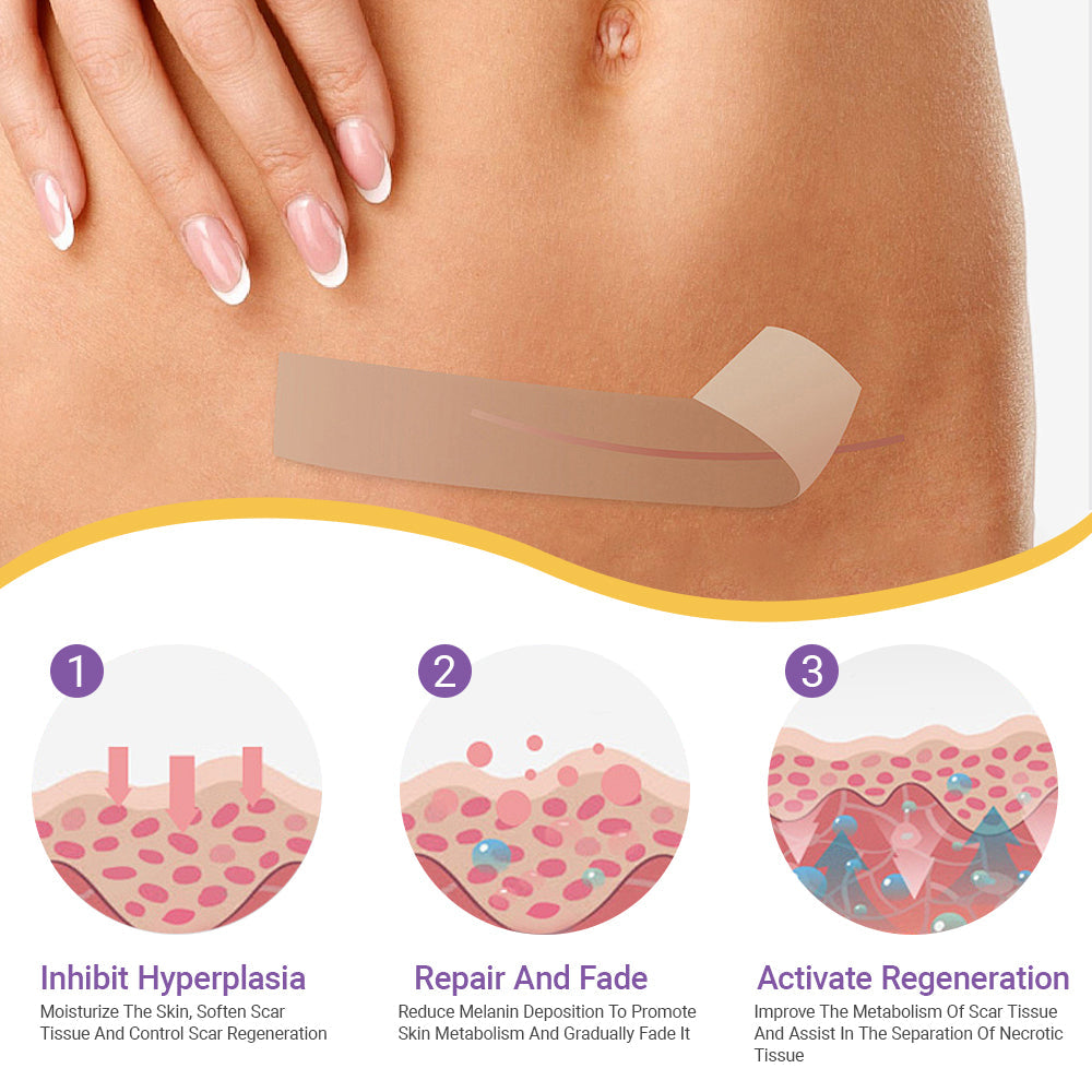 ✅ TAILEDEN™ Official | Nano Microneedle Scar & Wrinkle Repair Tape 🌿 Targets Scars, Fine Lines, Skin Laxity – Multi-Area Use (1.6in x 59in)