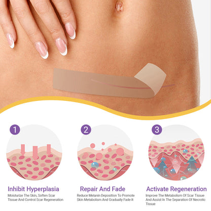 ✅ TAILEDEN™ Official | Nano Microneedle Scar & Wrinkle Repair Tape 🌿 Targets Scars, Fine Lines, Skin Laxity – Multi-Area Use (1.6in x 59in)
