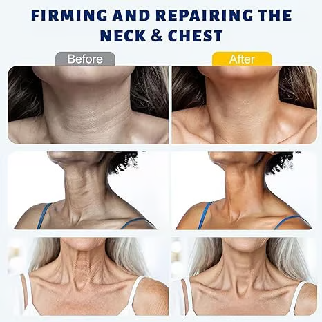 🌼Roller Massage Neck Cream 🧴 Collagen & Hyaluronic Acid | Firms Neck, Reduces Wrinkles & Double Chin