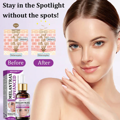 NESLEMY™ MelantraX Advanced Anti-Hyperpigmentation Essence