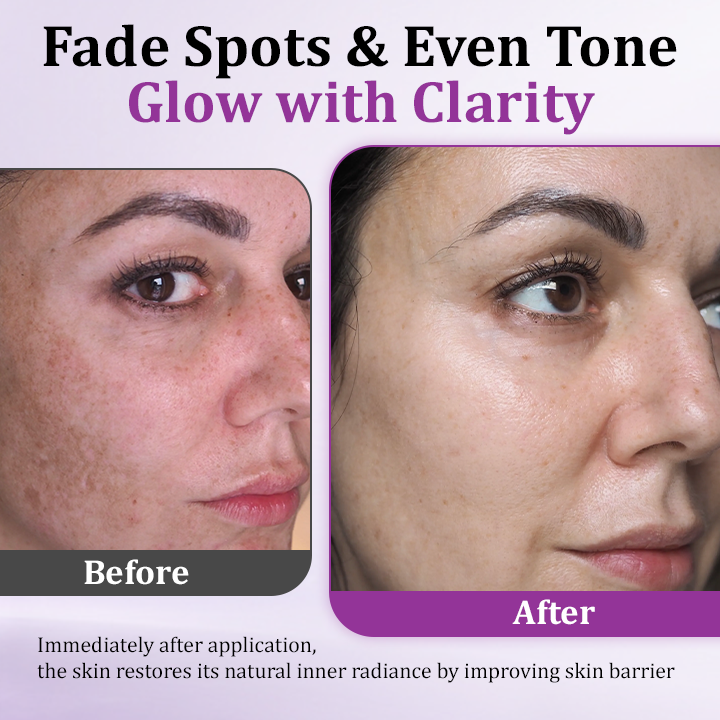 NESLEMY™ MelantraX Advanced Anti-Hyperpigmentation Essence