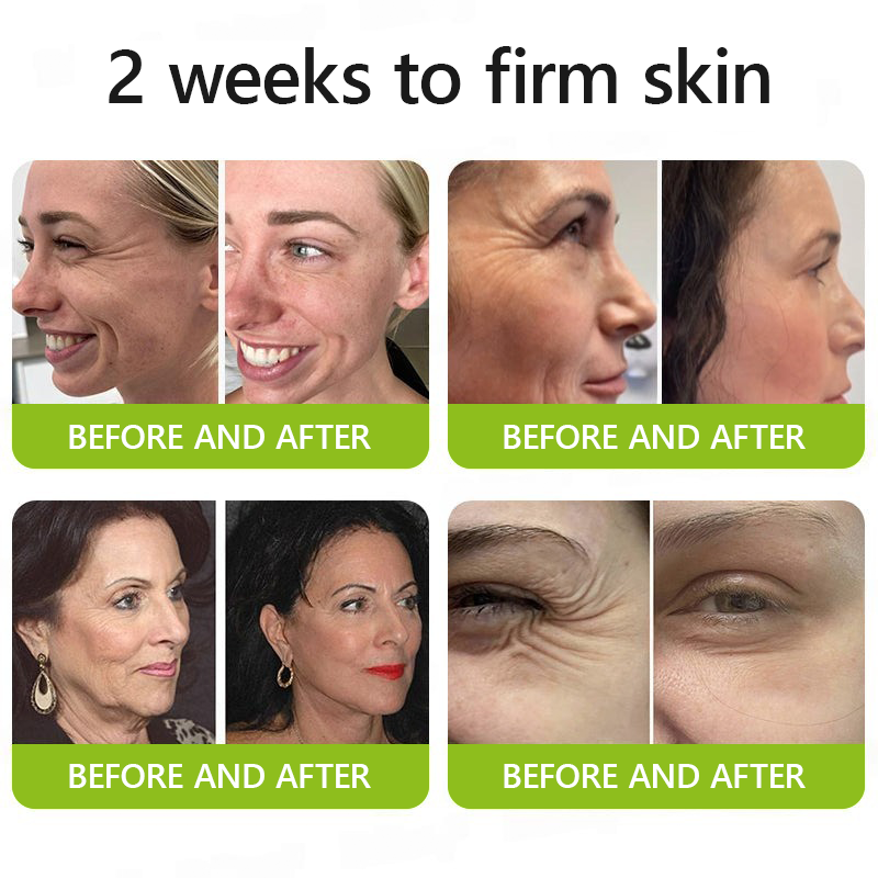 [🔥Last Day 70% OFF] ODALIT™ Botox & Retinol Shot - Eraser for Deep Wrinkles, Sagging Jowls & Puffy Eyes