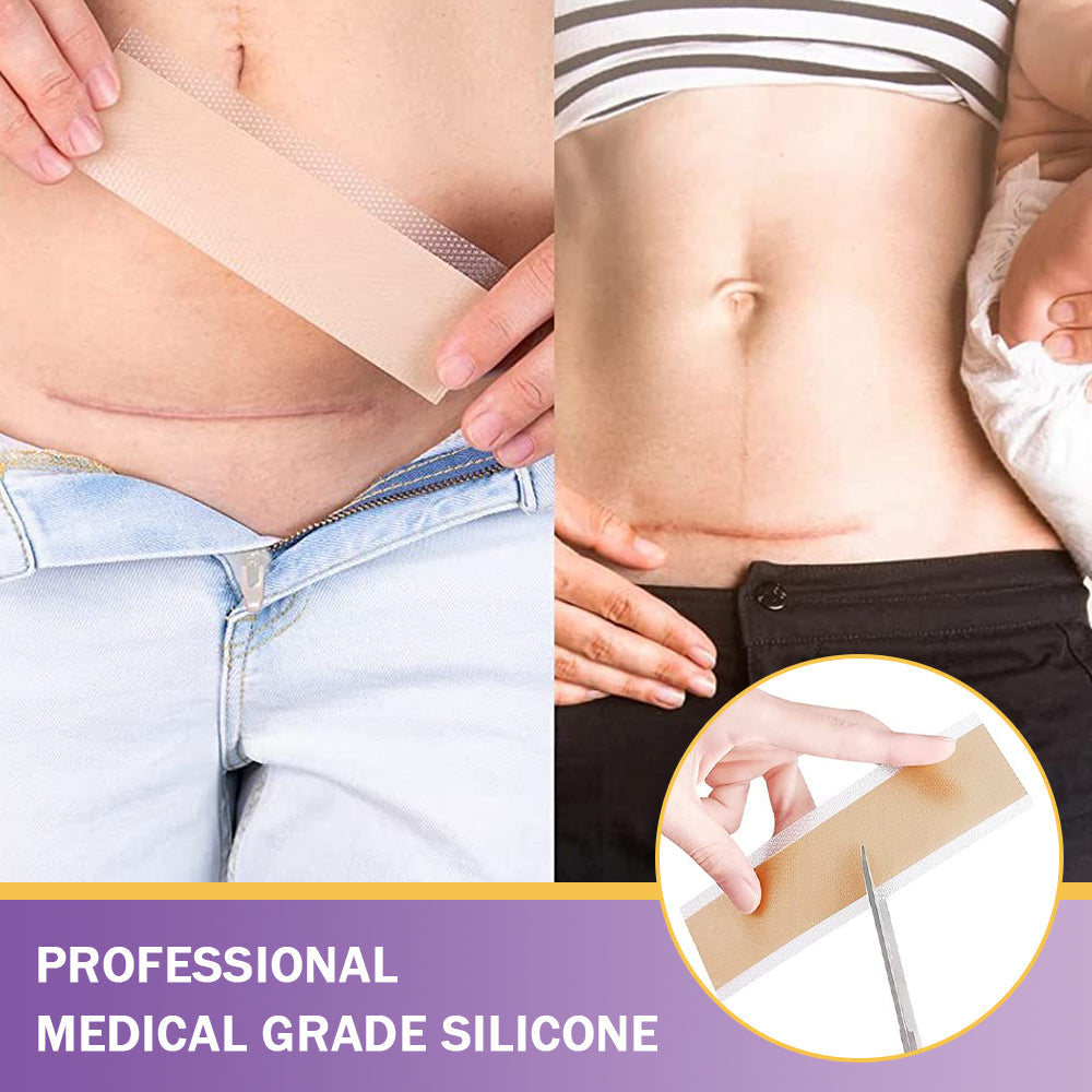 ✅ TAILEDEN™ Official | Nano Microneedle Scar & Wrinkle Repair Tape 🌿 Targets Scars, Fine Lines, Skin Laxity – Multi-Area Use (1.6in x 59in)