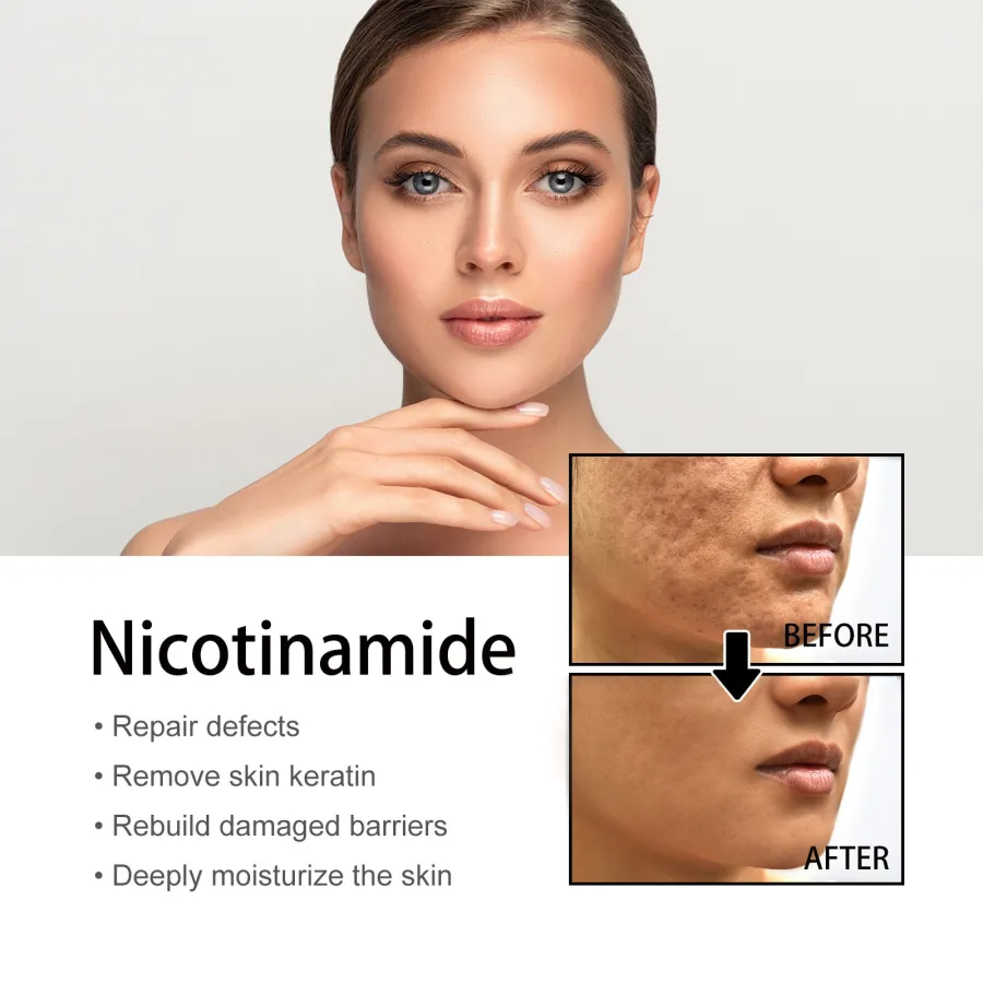 10% Niacinamide Spots Removal Serum 🎉Second Item half price🎉