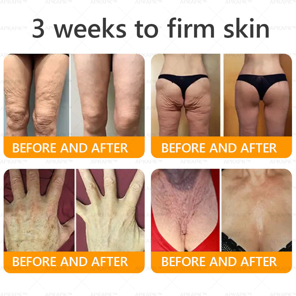 Made and Shipped from USA ✨ LBMLBM™ Bee venom Comprehensive Cream 🔥 LAST DAY 80% OFF 💎💎