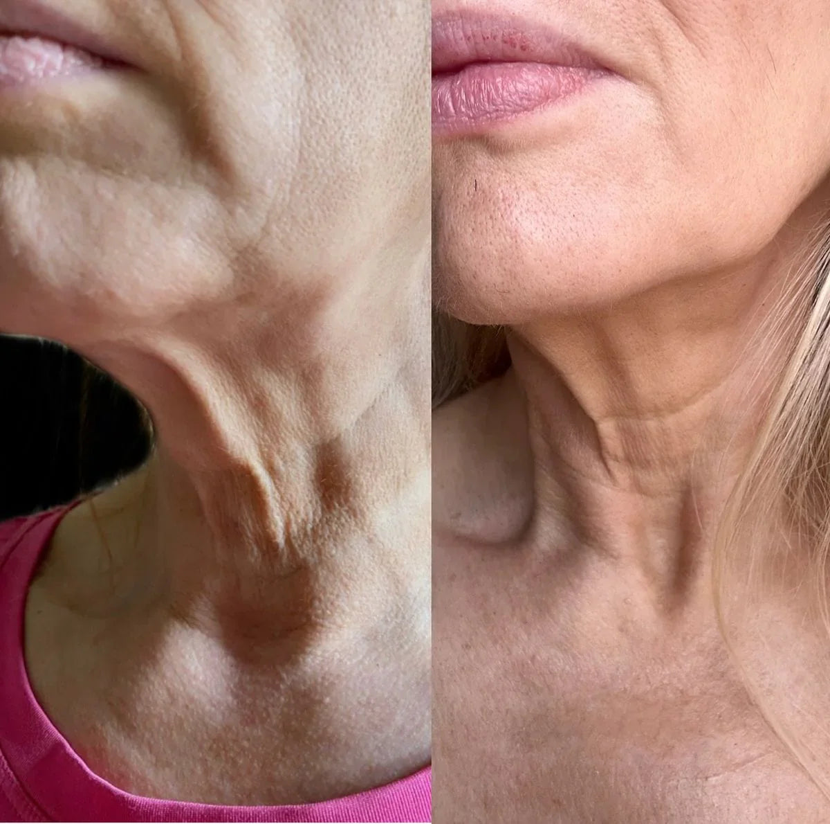 🌼Roller Massage Neck Cream 🧴 Collagen & Hyaluronic Acid | Firms Neck, Reduces Wrinkles & Double Chin