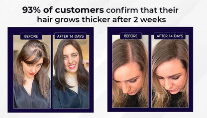 🌿 LOVILDS™ Natural Hair Regrowth Spray – 70% OFF Ends Tonight!