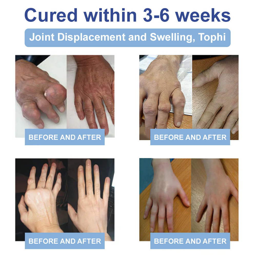 ✅TAILEDEN® 𝐌𝐚𝐠𝐧𝐞𝐬𝐢𝐮𝐦 𝐏𝐚𝐢𝐧 𝐇𝐞𝐚𝐥𝐢𝐧𝐠 𝐁𝐨𝐧𝐞 𝐂𝐫𝐞𝐚𝐦 (Relief of neuropathy, rheumatic diseases, arthritis, muscle spasms, twitches and sports injuries)