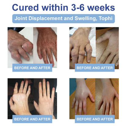 ✅TAILEDEN® 𝐌𝐚𝐠𝐧𝐞𝐬𝐢𝐮𝐦 𝐏𝐚𝐢𝐧 𝐇𝐞𝐚𝐥𝐢𝐧𝐠 𝐁𝐨𝐧𝐞 𝐂𝐫𝐞𝐚𝐦 (Relief of neuropathy, rheumatic diseases, arthritis, muscle spasms, twitches and sports injuries)