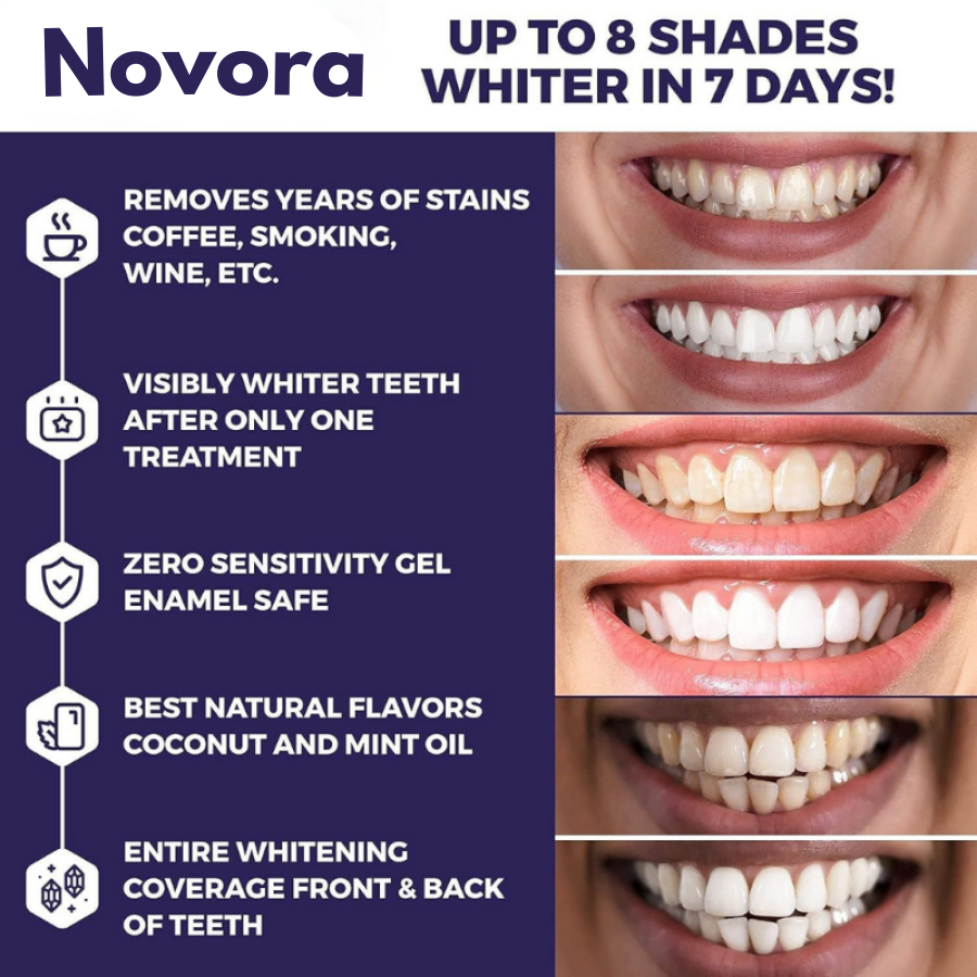 Purple Teeth Whitening Strips