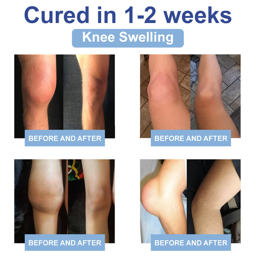 ✅TAILEDEN® 𝐌𝐚𝐠𝐧𝐞𝐬𝐢𝐮𝐦 𝐏𝐚𝐢𝐧 𝐇𝐞𝐚𝐥𝐢𝐧𝐠 𝐁𝐨𝐧𝐞 𝐂𝐫𝐞𝐚𝐦 (Relief of neuropathy, rheumatic diseases, arthritis, muscle spasms, twitches and sports injuries)
