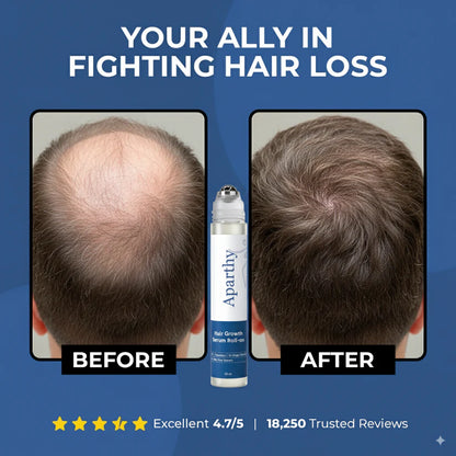 Newplum: Advanced Hair Growth Roll-On Serum