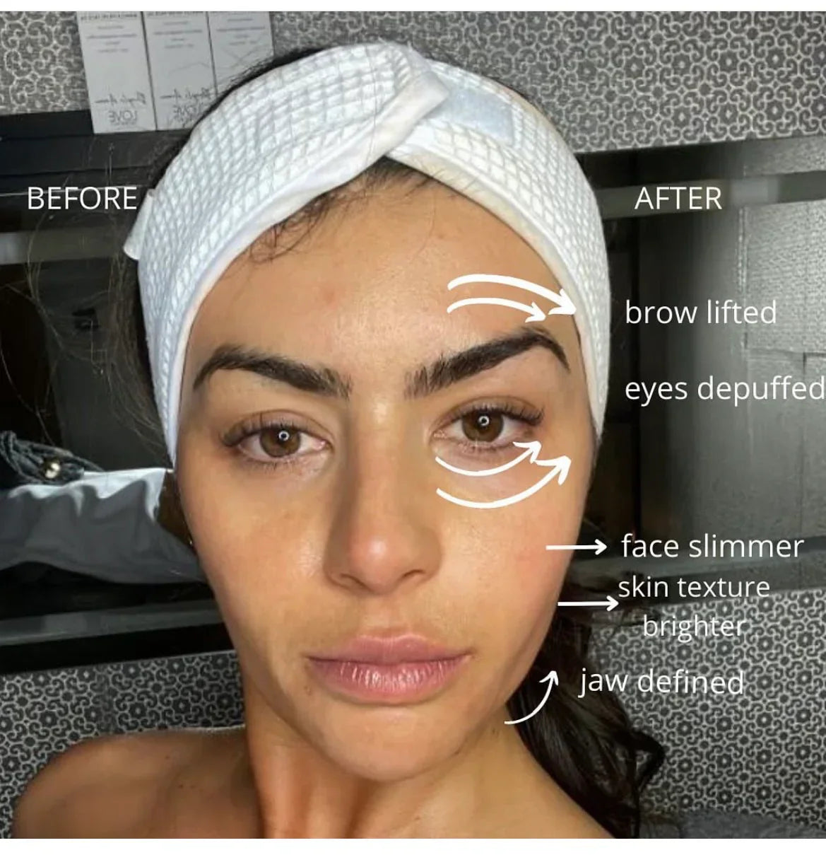 NESLEMY™ Lymphatic Face Brush — Instantly Reduce Puffiness & Sculpt Your Jawline
