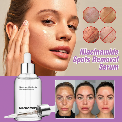 10% Niacinamide Spots Removal Serum 🎉Second Item half price🎉
