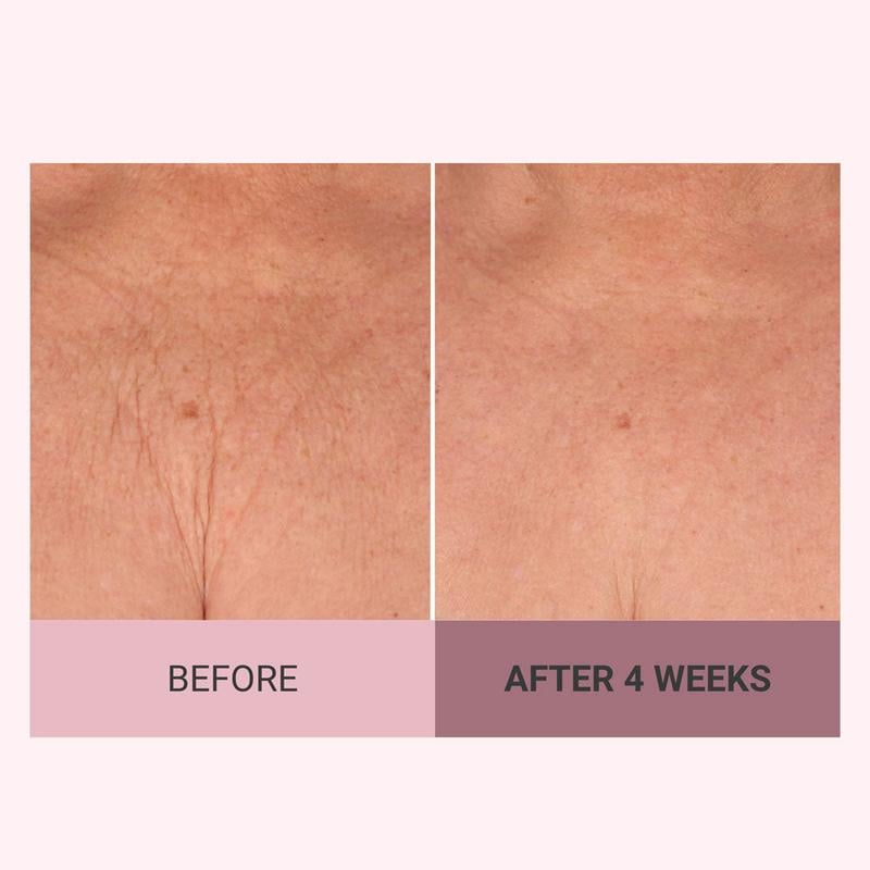 🌟 Experience the Glow of Firmer, Smoother, More Radiant Skin✨