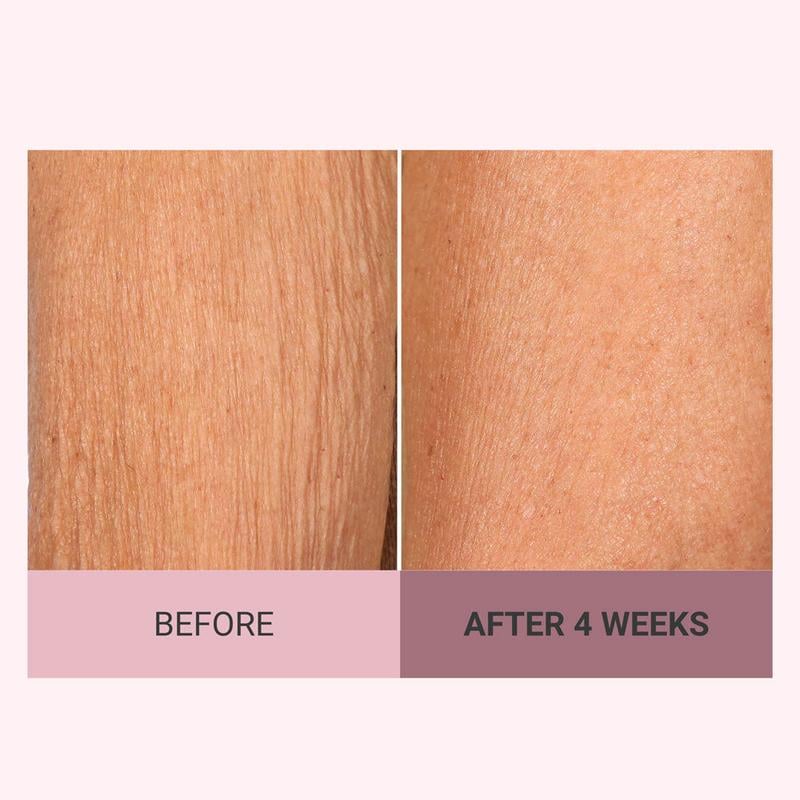 🌟 Experience the Glow of Firmer, Smoother, More Radiant Skin✨