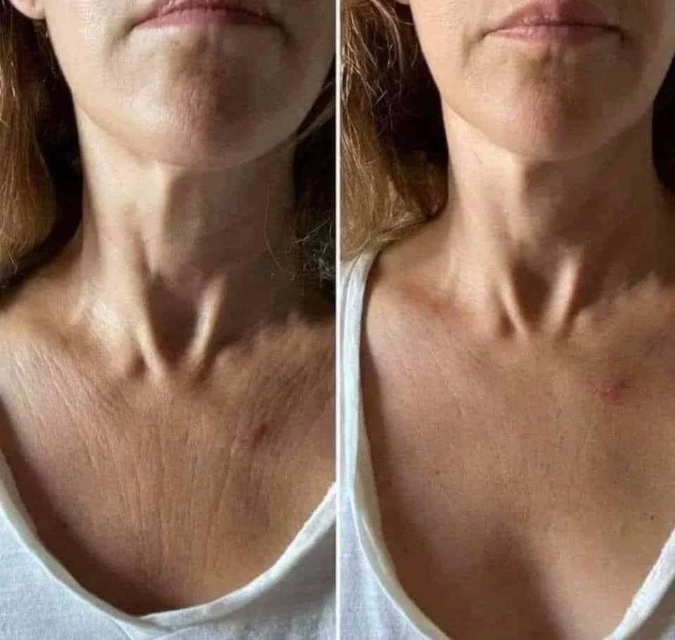 🌼Roller Massage Neck Cream 🧴 Collagen & Hyaluronic Acid | Firms Neck, Reduces Wrinkles & Double Chin