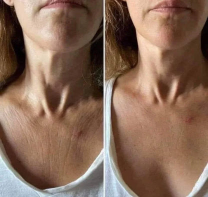 🌼Roller Massage Neck Cream 🧴 Collagen & Hyaluronic Acid | Firms Neck, Reduces Wrinkles & Double Chin