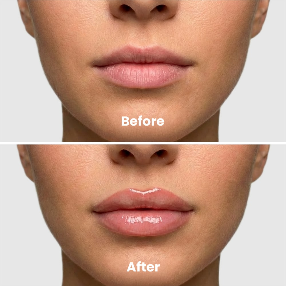 🌺New Releases - 💖60% OFF🌺Extreme Lip Plumper