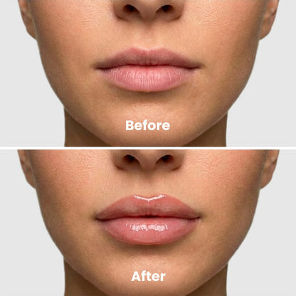 🌺New Releases - 💖60% OFF🌺Extreme Lip Plumper