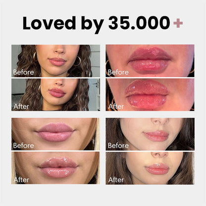 🌺New Releases - 💖60% OFF🌺Extreme Lip Plumper