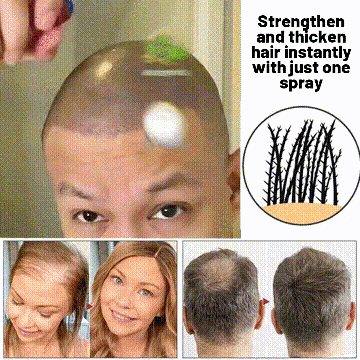 🌿 LOVILDS™ Natural Hair Regrowth Spray – 70% OFF Ends Tonight!
